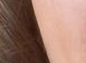 Reduce "Microline"